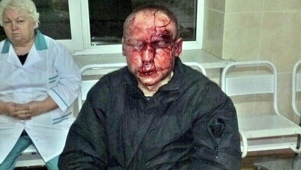 Учащийся ешивы Торат Хаим Шломо (Федор) Романовский после нападения на него в Московской области Учащийся ешивы Торат Хаим Шломо (Федор) Романовский после нападения на него в Московской области