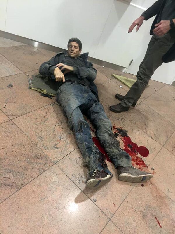 Пострадавшие во время взрыва в аэропорту Брюсселя. 22 марта 2016 Пострадавшие во время взрыва в аэропорту Брюсселя. 22 марта 2016