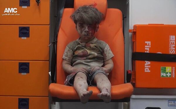 Пострадавший при обстреле Алеппо сирийский мальчик Омран. 17 августа 2017 Пострадавший при обстреле Алеппо сирийский мальчик Омран. 17 августа 2017