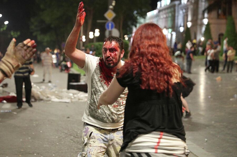 Мужчина, пострадавший во время акции протеста у здания парламента Грузии в Тбилиси Мужчина, пострадавший во время акции протеста у здания парламента Грузии в Тбилиси